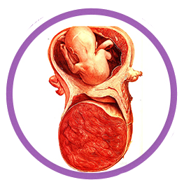 Gestational Trophoblastic Disease