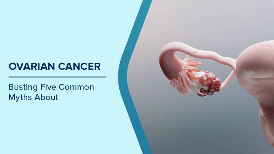 Ovarian Cancer: Busting Five Common Myths